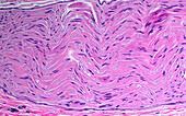 Normal nerve, light micrograph