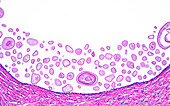 Prostate corpora amylacea, light micrograph