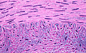 Artery elastic lamina, light micrograph