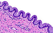 Inner cervix glands, light micrograph