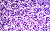 Small bowel, light micrograph