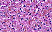 Liver cells with lipofuscin pigment, light micrograph