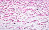 Collagen fibres, light micrograph