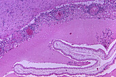 Cysticercosis of the brain, light micrograph