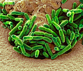 Bacteria from stagnant water, SEM