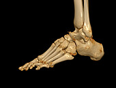 Foot, 3D CT scan