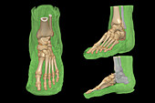 Foot, 3D CT scans