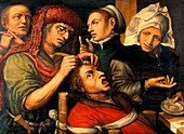 An Operation for Stone in the Head, illustration