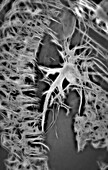 Pulmonary artery, CT scan