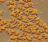 Group A Streptococcus bacteria, SEM