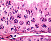 Male germinal epithelium, light micrograph
