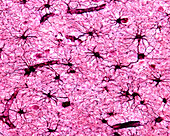 Protoplasmic astrocytes, light micrograph
