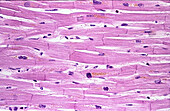 Human heart myocardium, light micrograph