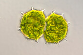 Xanthidium armatum algae, light micrograph