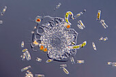 Amoeba with Euglena and diatoms, light micrograph