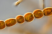 Ectocarpales algae, light micrograph
