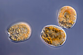Prorocentrum lima algae, light micrograph