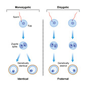Monozygotic and dizygotic twins, illustration