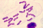 Harlequin chromosomes, light micrograph