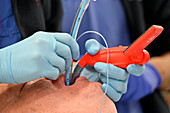 Patient being intubated