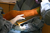 Total knee replacement surgery