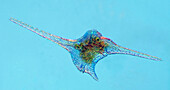 Ceratium dinoflagellate, light micrograph