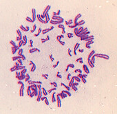 Mitosis, light micrograph