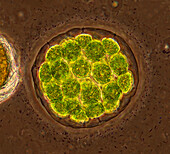 Eudorina green algae, light micrograph