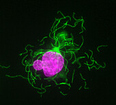 Interphase cell treated with Colchicine, light micrograph