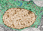 Thyrotropic cell in anterior pituitary gland, TEM