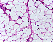 Adipose tissue, light micrograph