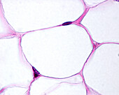 Adipocytes, light micrograph