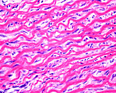 Aorta, light micrograph