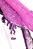 Human ciliary body and iris, light micrograph