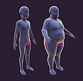 Boy before and after gaining weight, illustration