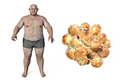 Obese man and fat cells, illustration