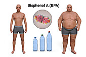 Link between plastics and obesity, conceptual illustration