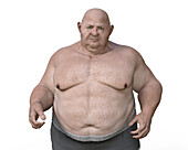 Obese man standing, illustration