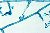 Madurella mycetomatis fungus, light micrograph