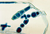 Epidermophyton floccosum fungus, light micrograph