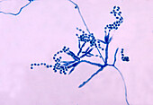 Talaromyces marneffei fungus, light micrograph
