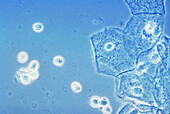 Trichomoniasis, light micrograph