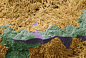 Tooth bacteria, SEM