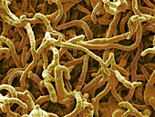 Fungal hyphae, SEM