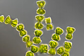 Staurastrum margaritaceum algae, light micrograph