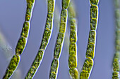 Tribonema sp. algae, light micrograph