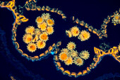 Daisy flower, fluorescent light micrograph