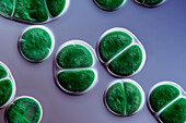 Chroococcus turgidus algae, light micrograph