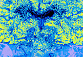 Cerebral arteries, CT scan