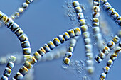 Staurosira algae, light micrograph